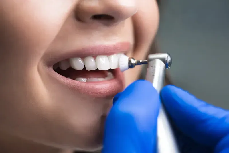How Often Should You Really Get a Dental Cleaning?