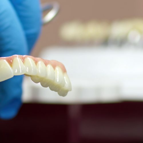 naccid-buford-dentist-porcelain-fixed-bridges-for-dental-concerns A dentist holds a porcelain fixed bridge - naccid buford dentist, GA